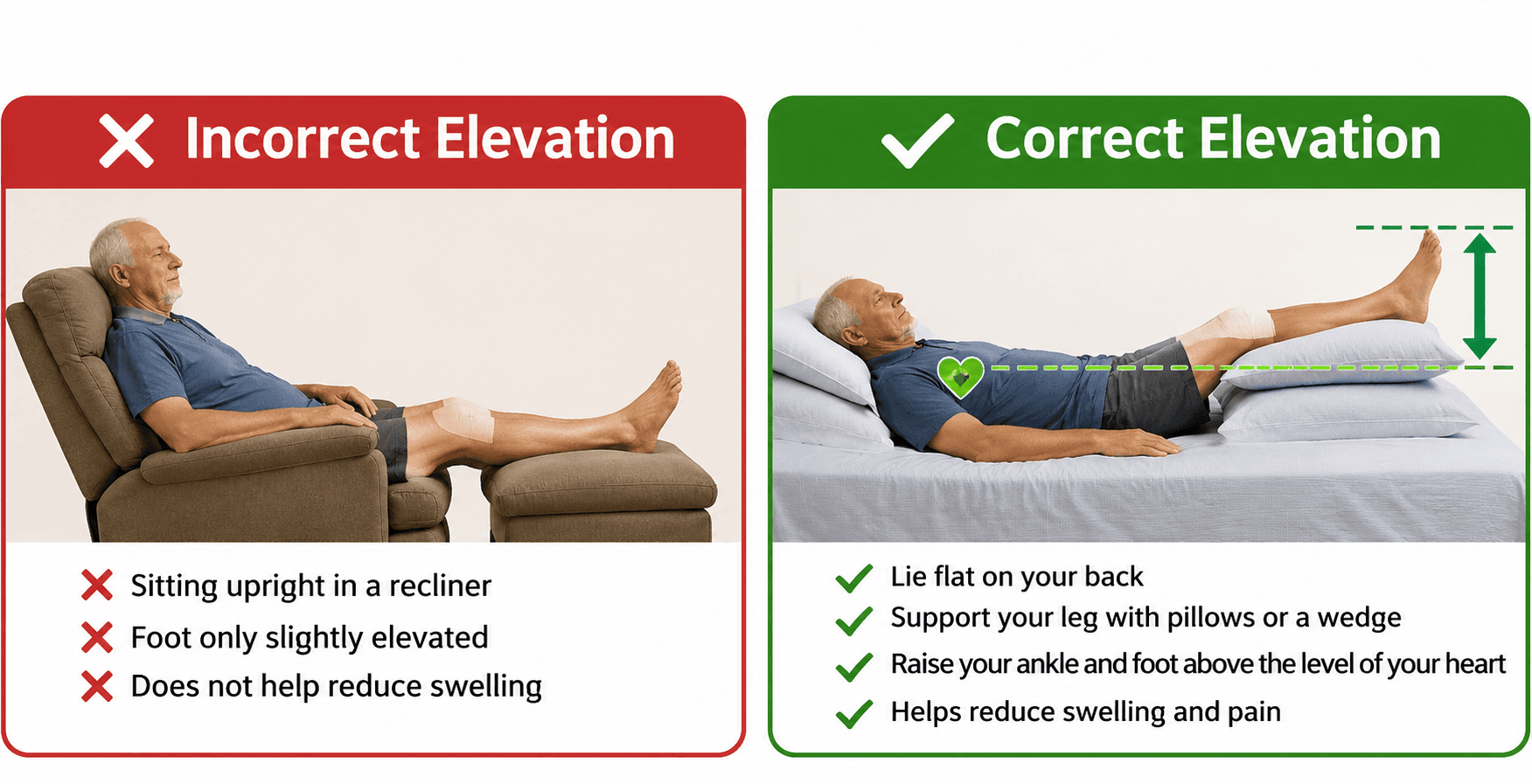 Comparison of a seated patient with the foot below heart level in a recliner and a patient lying back with the ankle and foot raised above heart level on pillows.